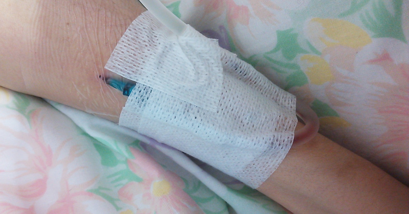 画像：オペについて